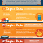 Burn Safety Tips For Summer