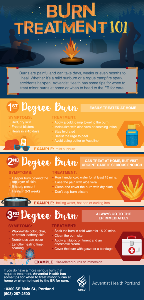 Burn Safety Tips For Summer