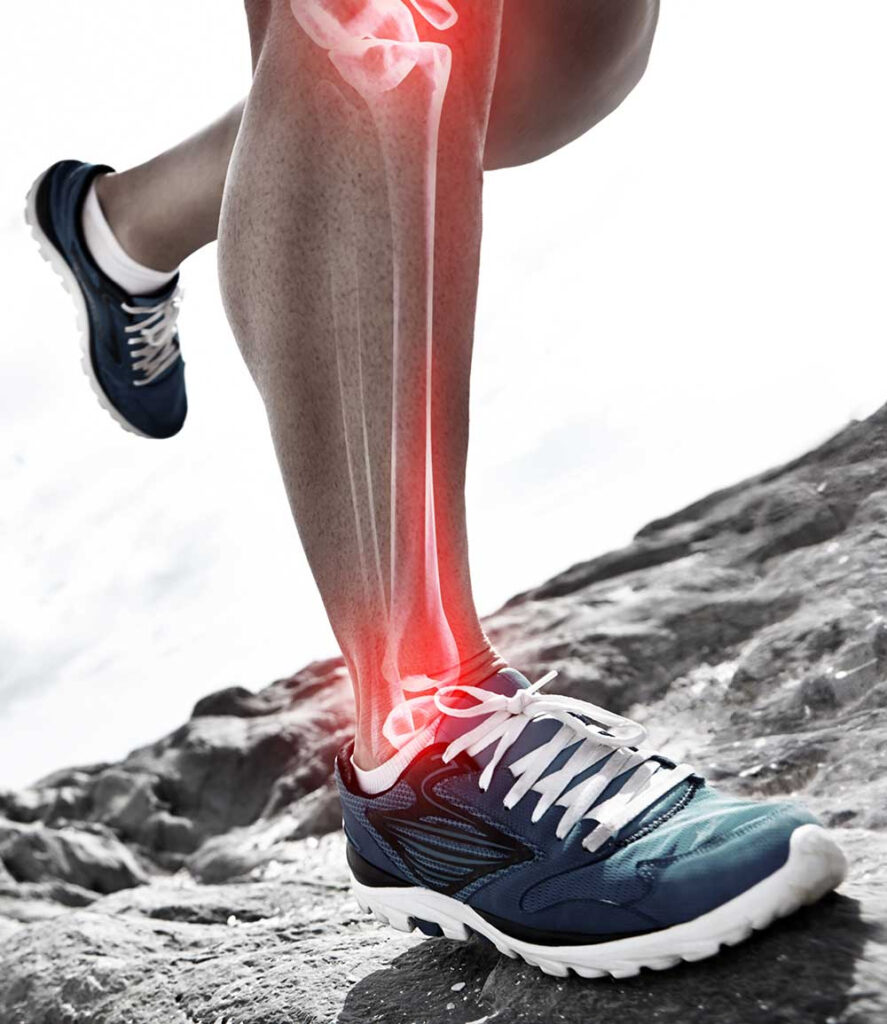 Podiatry Fees In Ipswich The Foot Ankle Specialists