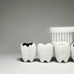 Tooth Decay The 5 Most Important Patient Questions Enamel Republic